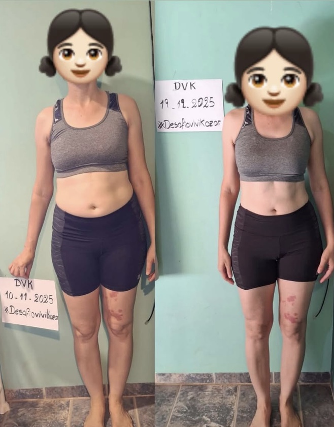 Comparativo de antes e depois de uma participante do DVK