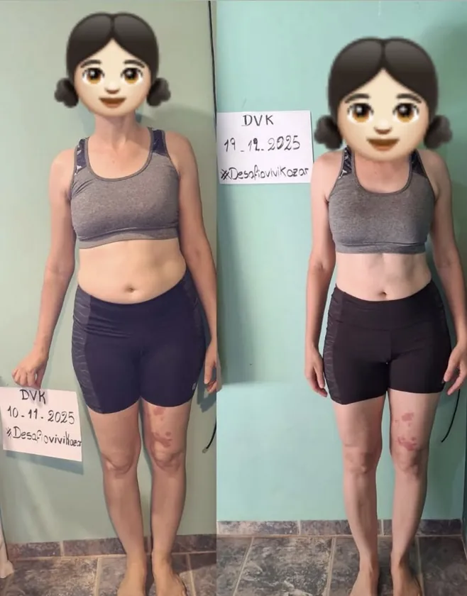 Comparativo de antes e depois de uma participante do DVK