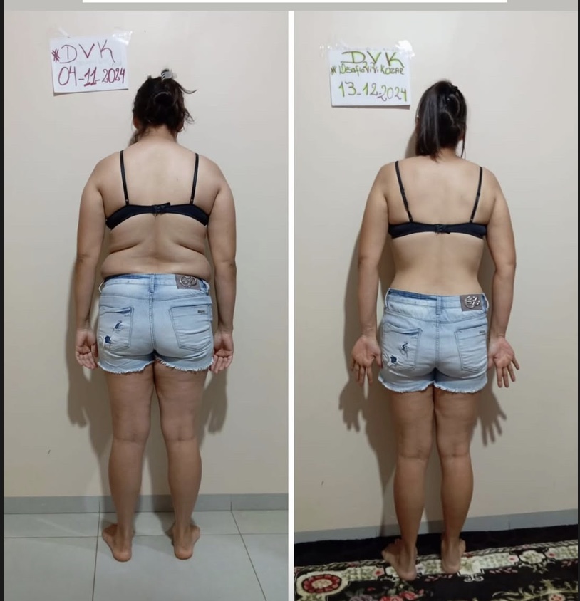 Comparativo de costas antes e depois de uma participante do DVK