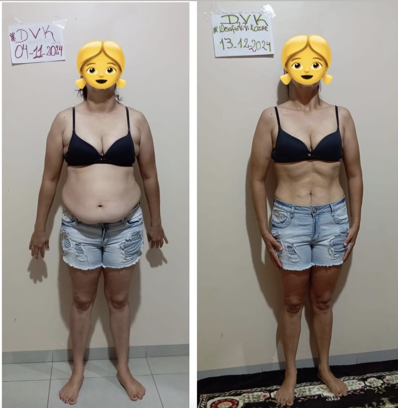 Comparativo frontal antes e depois de uma participante do DVK
